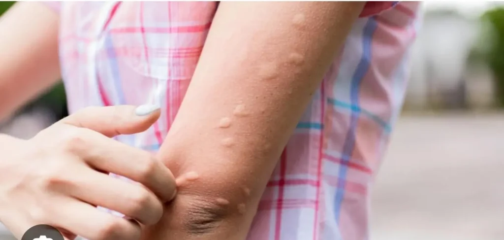 plaga de mosquitos